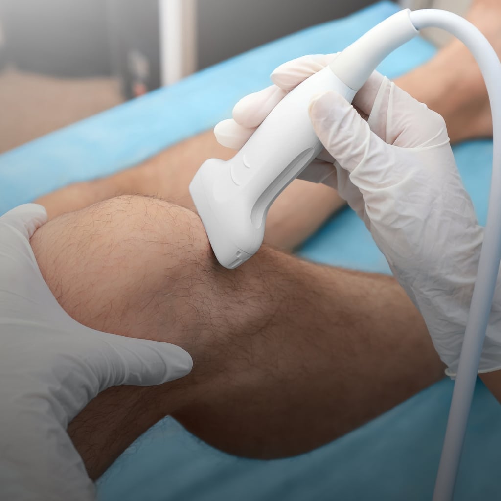 doctor doing ultrasound on knee